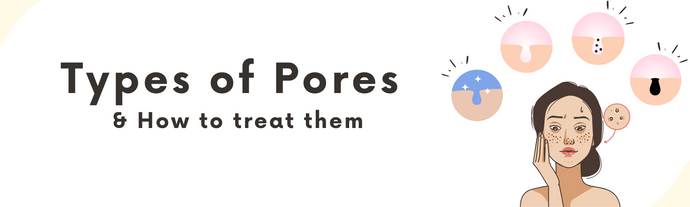 Types of Pores & How to treat them