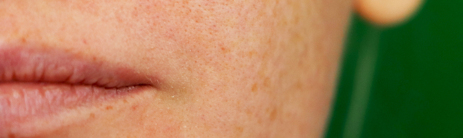 Pigmentation Care