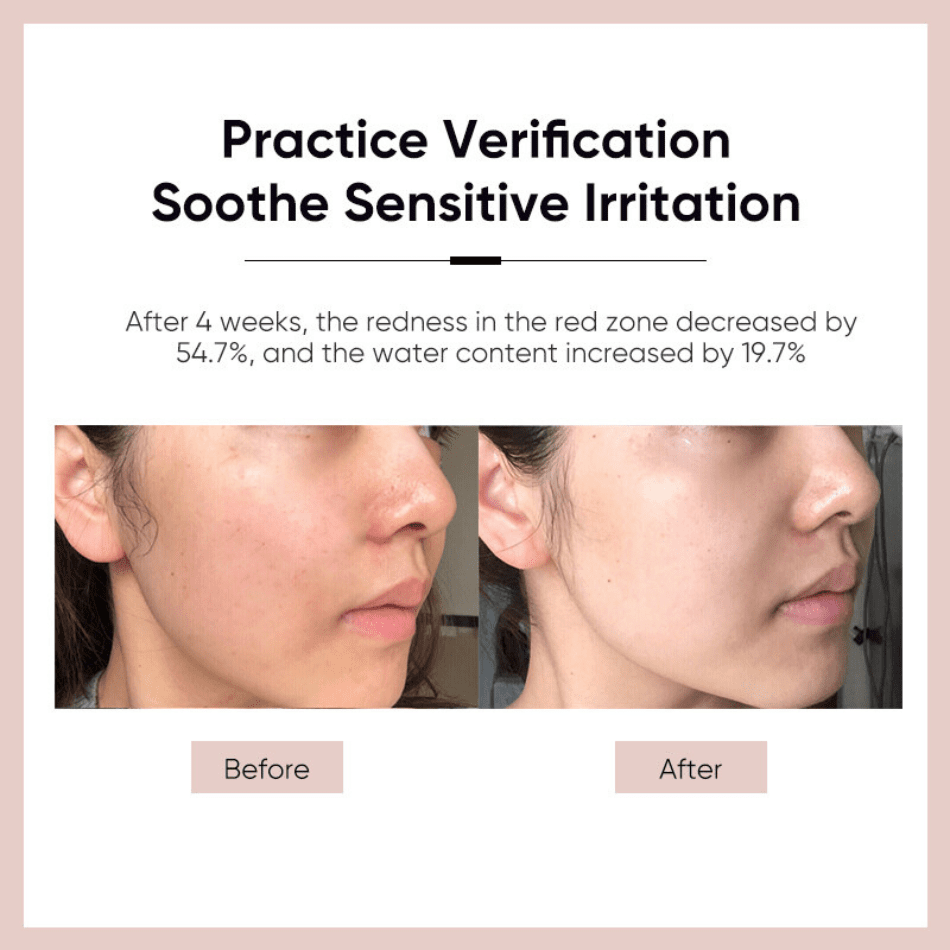 Inoherb Gentiana Soothing Moisturizing Lotion | hebeloft