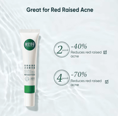 INOHERB White Willow Bark Anti-Acne Gel 25G (NEW) | hebeloft