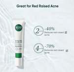 INOHERB White Willow Bark Anti-Acne Gel 25G (NEW) | hebeloft
