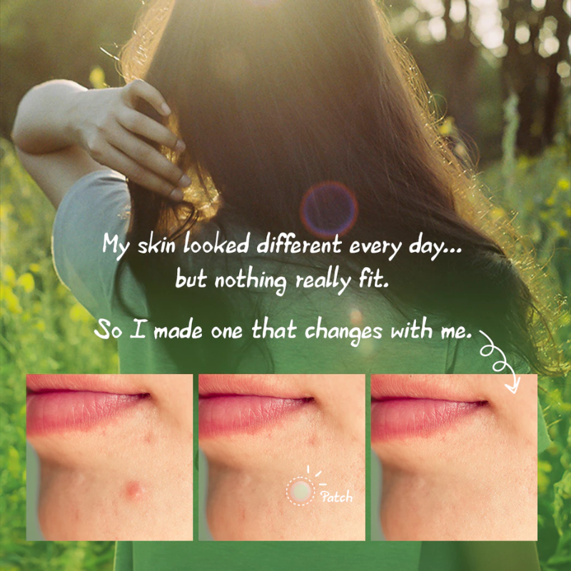 Nolahour Spot Eraser Green Step 1 (9 Patches) | hebeloft