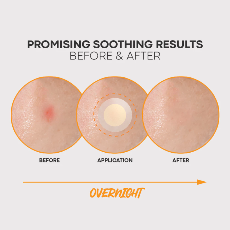 Nolahour Spot Eraser Orange Step 3 (12 Patches) | hebeloft