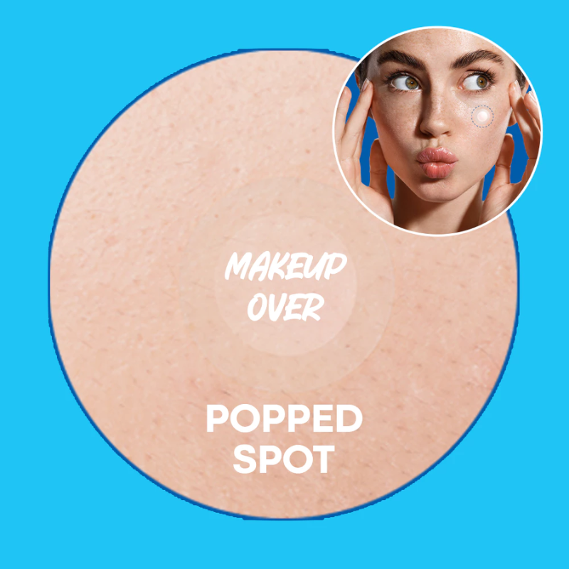 Nolahour Spot Eraser Blue Step 2 (63 Patches) | hebeloft