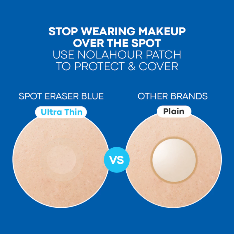 Nolahour Spot Eraser Blue Step 2 (63 Patches) | hebeloft